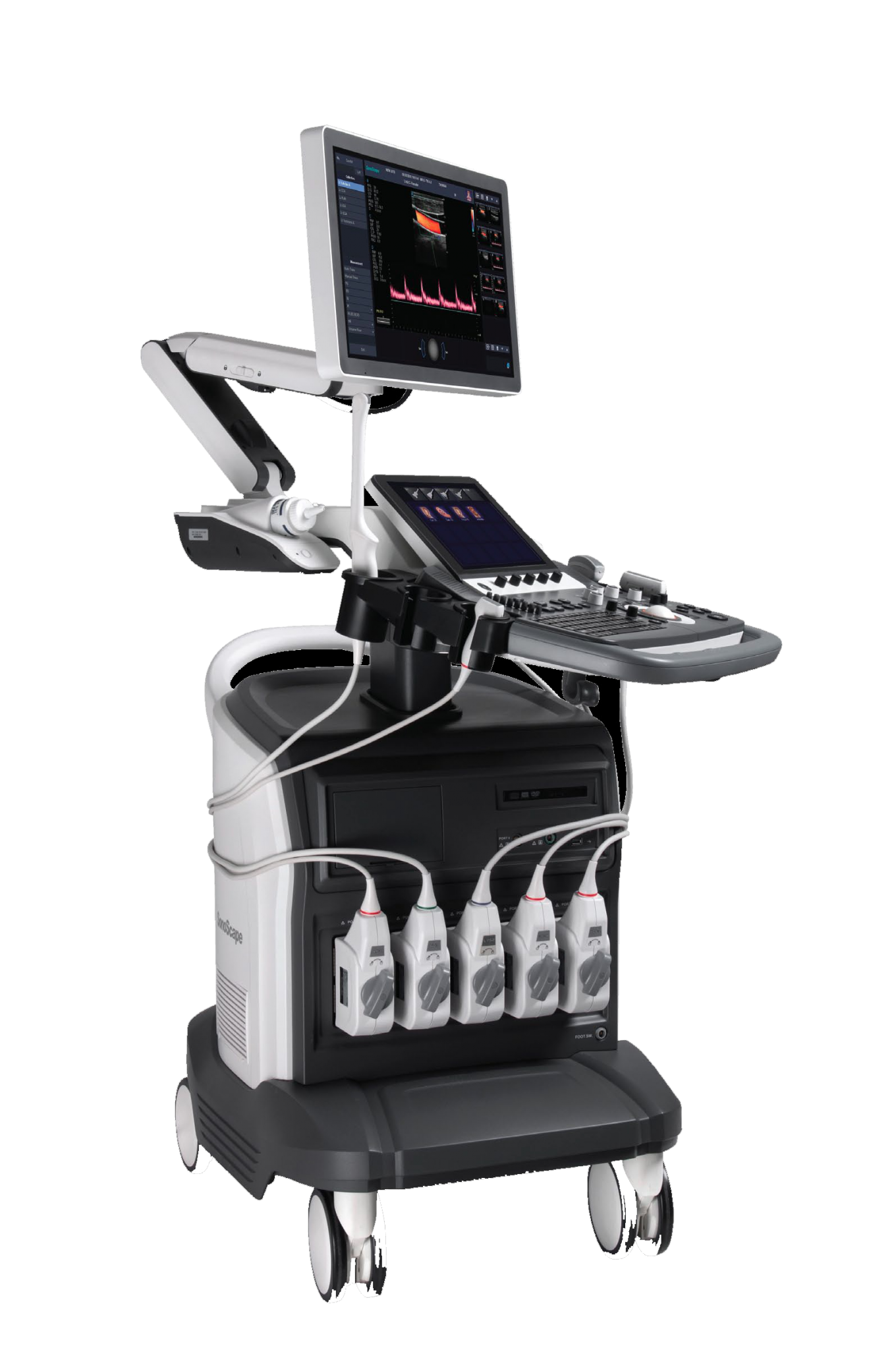 ECOGRAFO SONOSCAPE S50 - TECNOMEDICS COLOMBIA